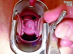 Marie de exámenes vulva con disfrutar de herramientas gyno en la clínica